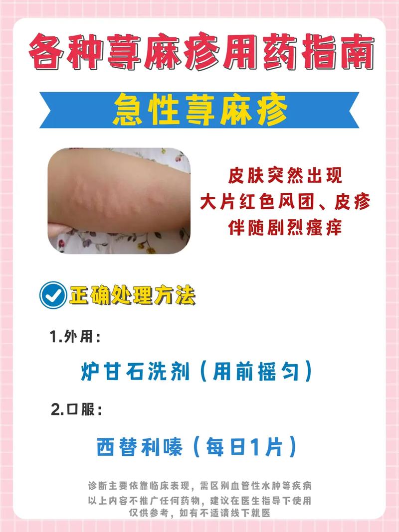 皮肤止痒的最快土方法,狗狗皮肤止痒的最快土方法-第4张图片-文史 皮肤止痒的最快土方法,狗狗皮肤止痒的最快土方法-第4张图片-文史
