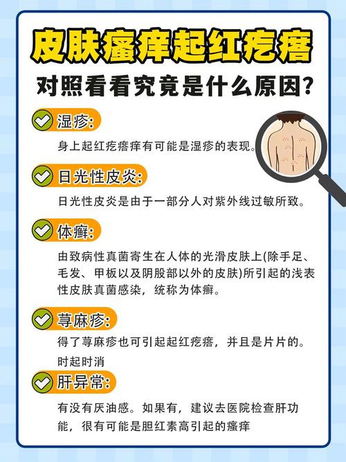 皮肤止痒的最快土方法,狗狗皮肤止痒的最快土方法-第7张图片-文史 皮肤止痒的最快土方法,狗狗皮肤止痒的最快土方法-第7张图片-文史