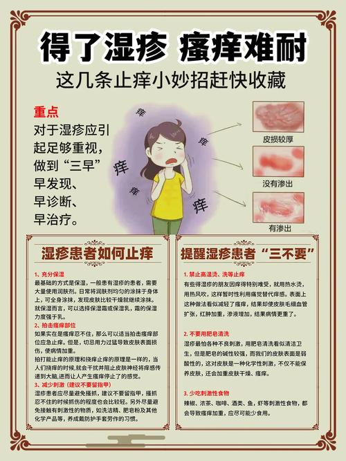 皮肤止痒的最快土方法,狗狗皮肤止痒的最快土方法-第8张图片-文史 皮肤止痒的最快土方法,狗狗皮肤止痒的最快土方法-第8张图片-文史